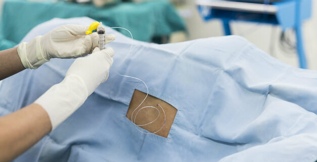 Analgesia epidurale ed allattamento